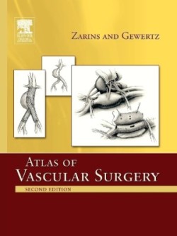 Atlas of Vascular Surgery /zarins/