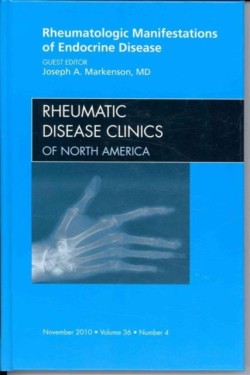 Rheumatologic Manifestations of Endocrine Disease, An Issue of Rheumatic Disease Clinics