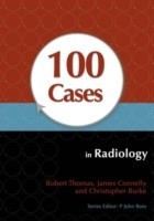 100 Cases in Radiology