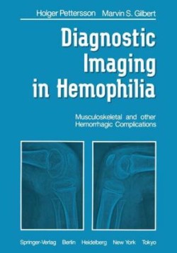 Diagnostic Imaging in Hemophilia