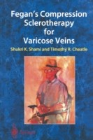 Fegan’s Compression Sclerotherapy for Varicose Veins