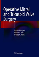 Operative Mitral and Tricuspid Valve Surgery