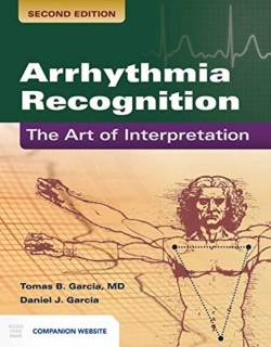 Arrhythmia Recognition: The Art of Interpretation