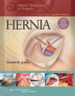 Master Techniques in Surgery: Hernia /USED/