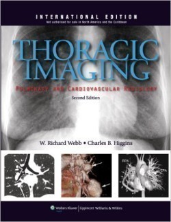 Thoracic Imaging: Pulmonary and Cardiovascular Radiology, 2nd Rev.Ed.