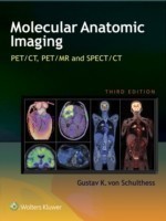 Molecular Anatomic Imaging : PET/CT, PET/MR and SPECT CT