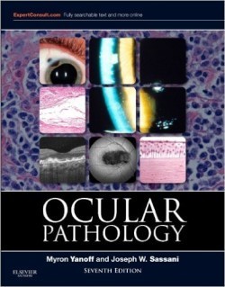 Ocular Pathology 7th Ed.