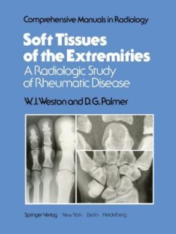 Soft Tissues of the Extremities