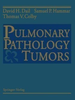 Pulmonary Pathology — Tumors