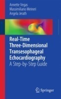 Real-time Three-dimensional Transesophageal Echocardiography: a Step-by-step Guide