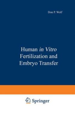 Human in Vitro Fertilization and Embryo Transfer