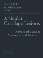 Articular Cartilage Lesions