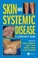 Skin and Systemic Disease