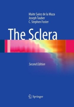 Sclera