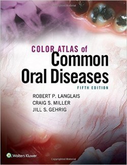 Color Atlas of Common Oral Diseases, 5th Ed.