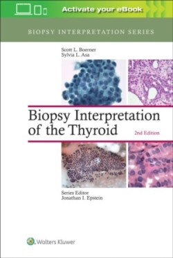 Biopsy Interpretation of the Thyroid, 2nd Ed.