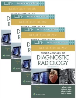 Brant and Helms' Fundamentals of Diagnostic Radiology, 5th Ed.