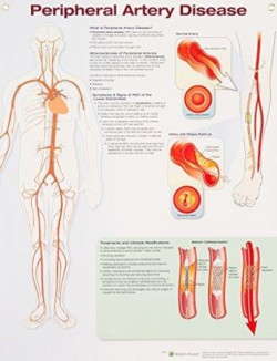 Peripheral Artery Disease