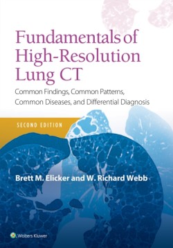 Fundamentals of High-Resolution Lung CT, 2nd ed.
