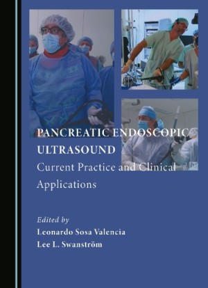 Pancreatic Endoscopic Ultrasound