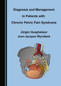 Diagnosis and Management in Patients with Chronic Pelvic Pain Syndrome