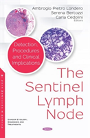 Sentinel Lymph Node