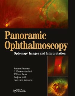 Panoramic Ophthalmoscopy