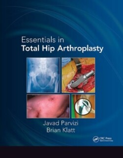 Essentials in Total Hip Arthroplasty