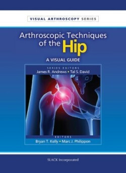 Arthroscopic Techniques of Hip