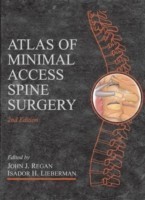Atlas of Minimal Access Spine Surgery
