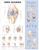 Knee Injuries Chart