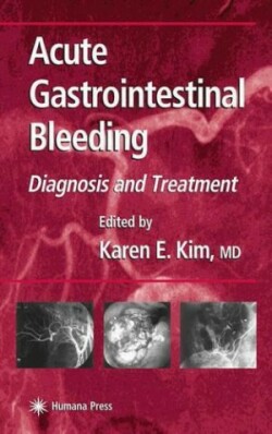 Acute Gastrointestinal Bleeding