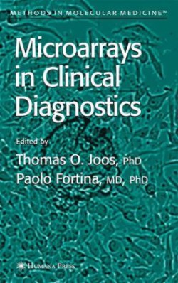 Microarrays in Clinical Diagnostics