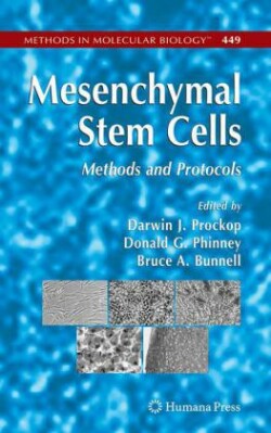 Mesenchymal Stem Cells