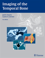 Imaging of Temporal Bone