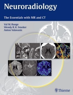 Neuroradiology