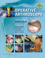 Operative Arthroscopy, 4th ed.