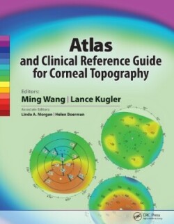 Atlas and Clinical Reference Guide for Corneal Topography