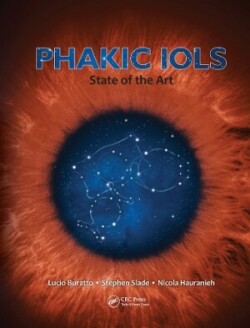 Phakic Iols