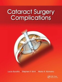 Cataract Surgery Complications