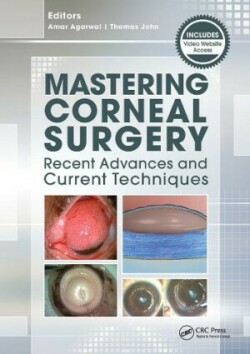 Mastering Corneal Surgery