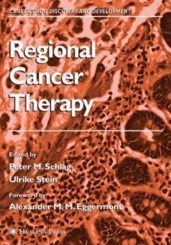 Regional Cancer Therapy