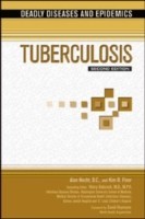 Tuberculosis