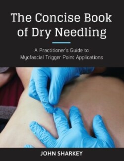 Concise Book of Dry Needling