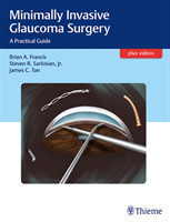 Minimally Invasive Glaucoma Surgery: A Practical Guide