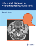 Differential Diagnosis in Neuroimaging: Head and Neck