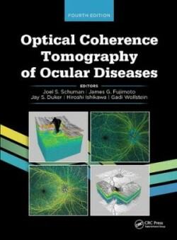 Optical Coherence Tomography of Ocular Diseases