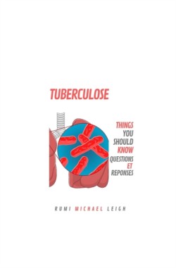 Tuberculose