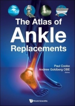 Atlas of Ankle Replacements