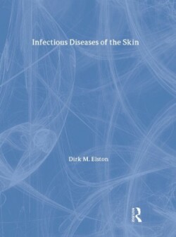 Infectious Diseases of Skin